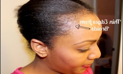 Black Hairstyles For Thin Edges 4