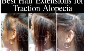 Hairstyles For Alopecia Sufferers 2