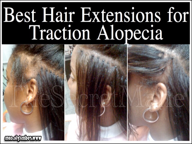 Hairstyles For Alopecia Sufferers 2